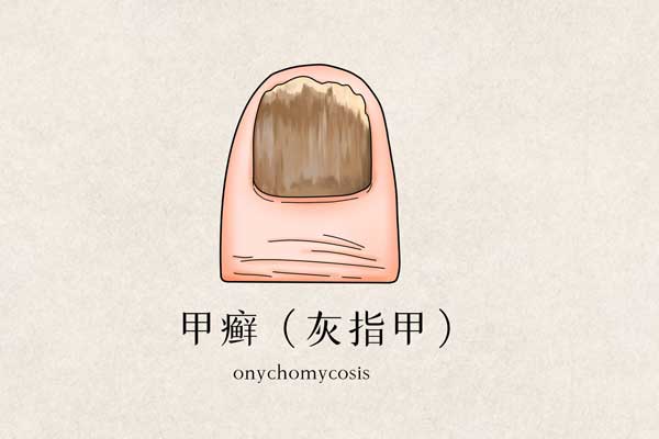 ��ָ����ʲô�� ��ָ����ôԤ��